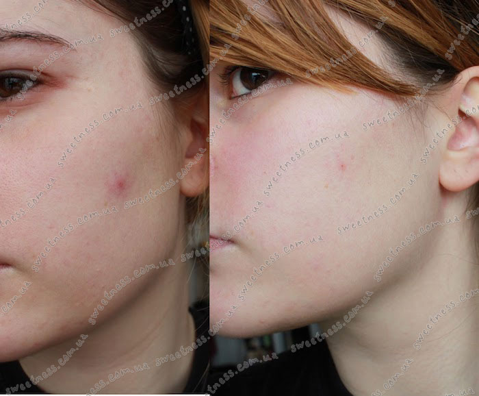 COSRX Natural BHA Skin Returning A-Sol Тонер с BHA кислотами, фото 5 | Sweetness