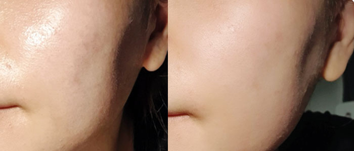 Себорегулирующая эмульсия-сыворотка для проблемной кожи Dr.Ceuracle 5α Control Clearing Serum in Emulsion фото 4 | Корейская косметика Sweetness