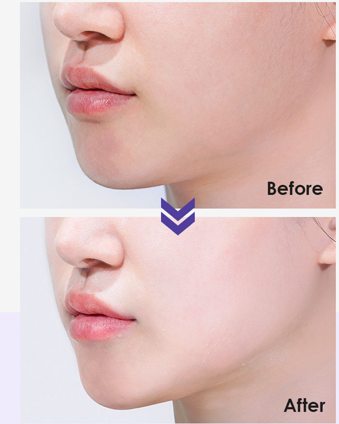 Medi-Peel Azulene Water Calming Mask Успокаивающая маска с азуленом фото 6 / Sweetness