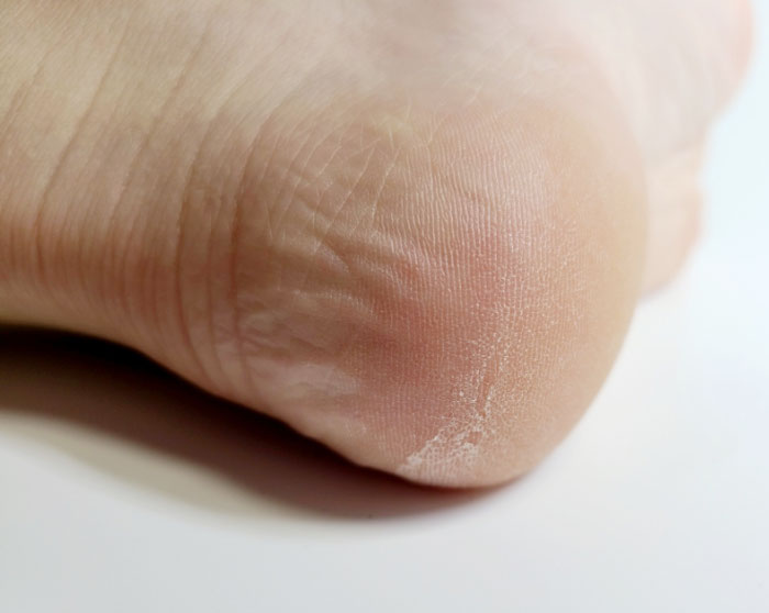 MEDI-PEEL EGF Scaling Moisture Foot Cream Пилинг-крем для ног фото 4 / Sweetness